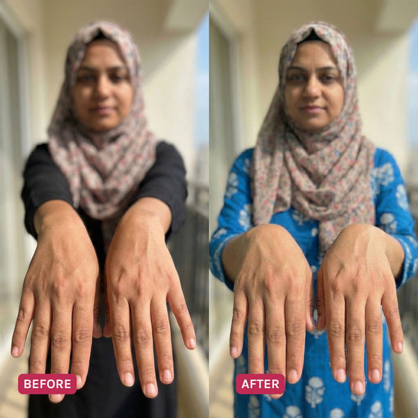 Visible Tan Reduction